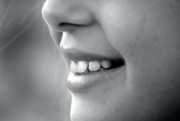 Le fasi del trattamento ortodontico: se ho già messo l'apparecchio perché lo devo rimettere?