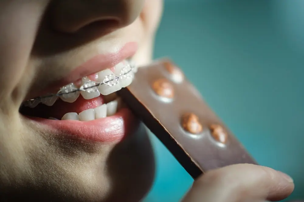 Cosa mangiare (e cosa evitare) con l'apparecchio fisso ai denti ...